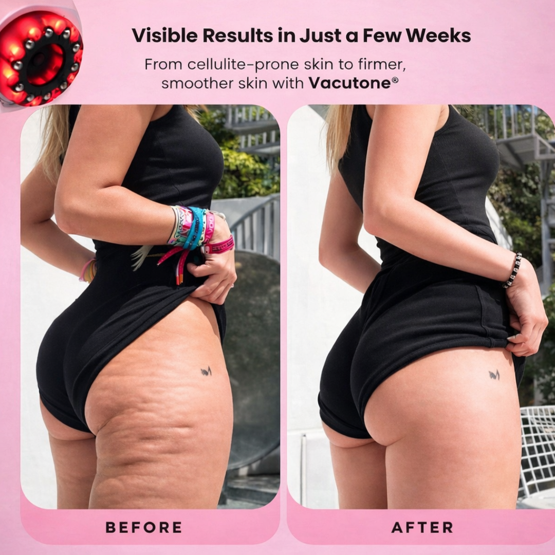 Vacutone Sculpt and Smooth Pro™